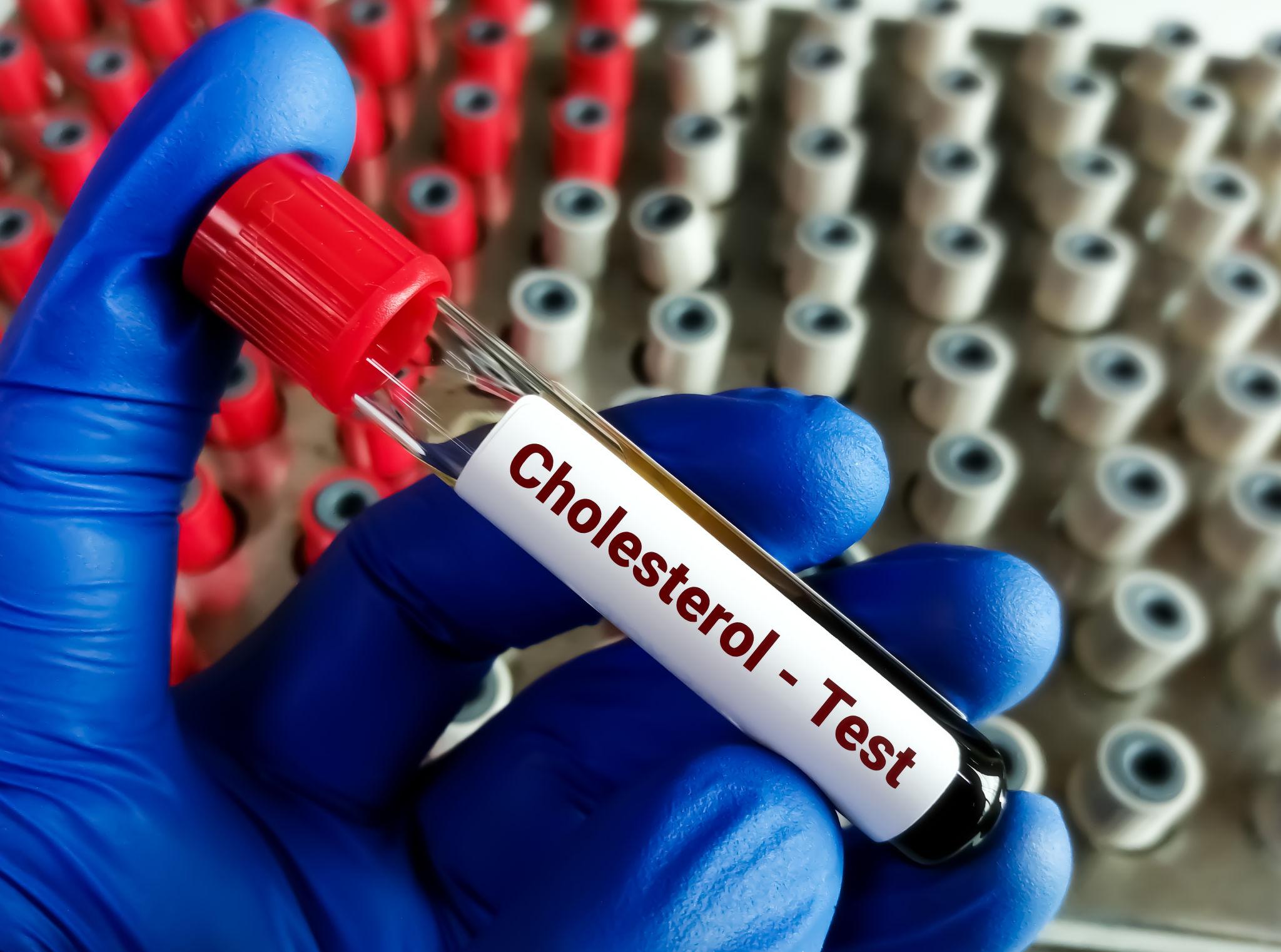 choresterol test